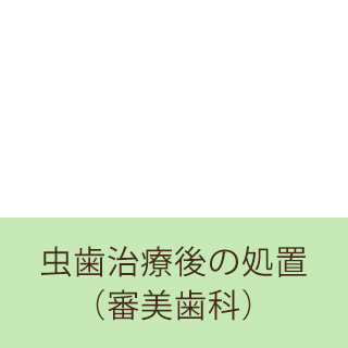 虫歯治療後の処置（審美歯科）